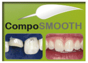 Kit CompoSmooth